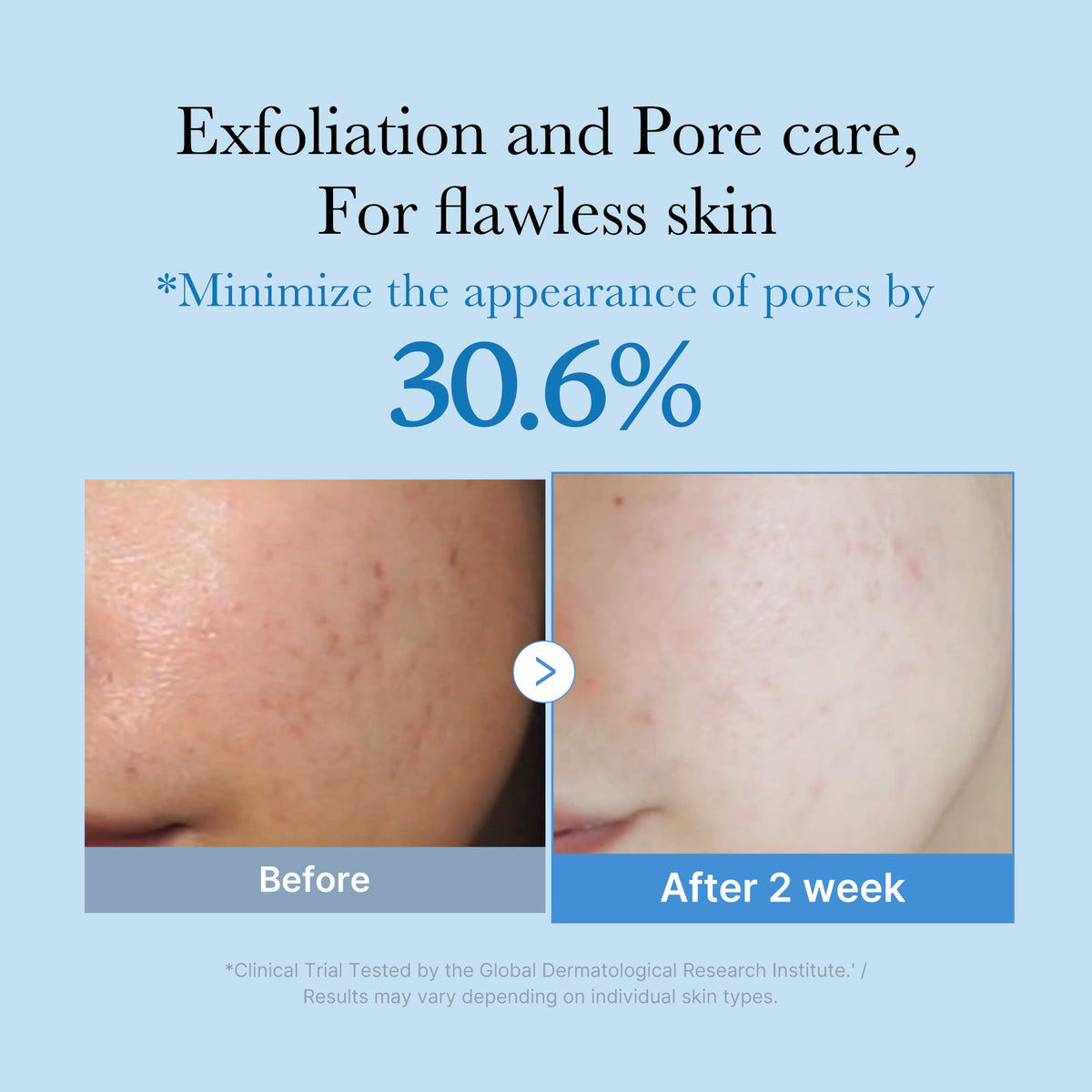 Toner Zero Pore