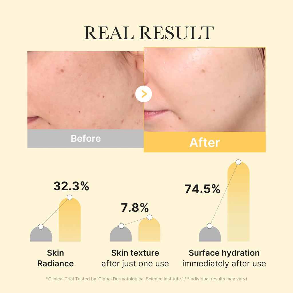 Masque gelée dorée en gel à l’acide kojique et au curcuma
