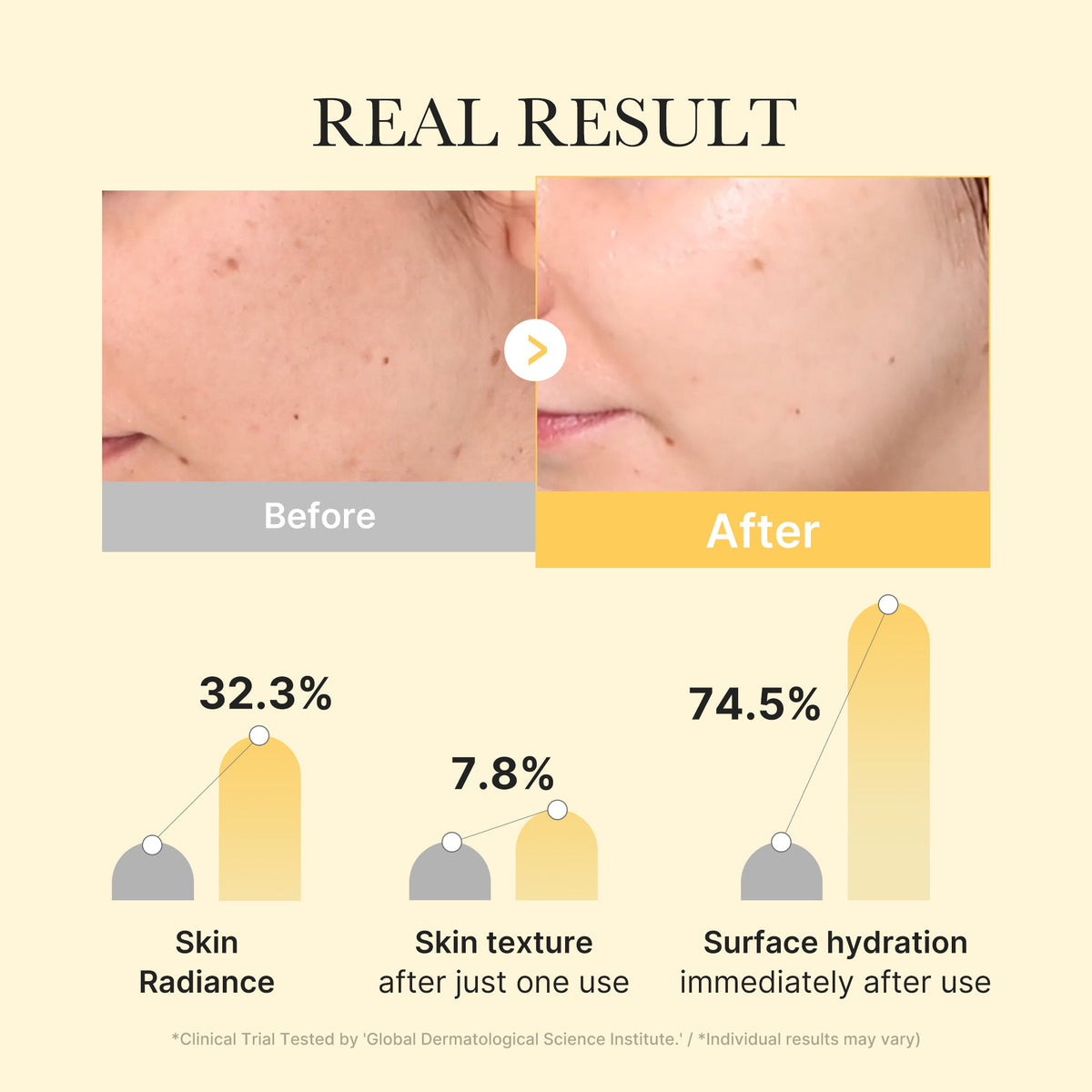 Masque gelée dorée en gel à l’acide kojique et au curcuma