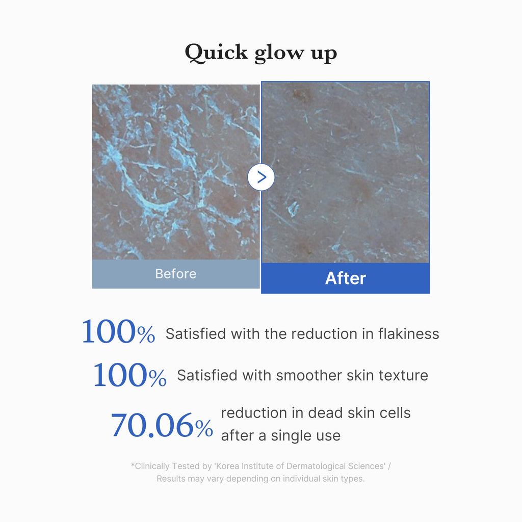 Patchs exfoliants Zero Pore (8ea)