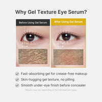 Sérum gel contour des yeux au curcuma et à l’acide kojique
