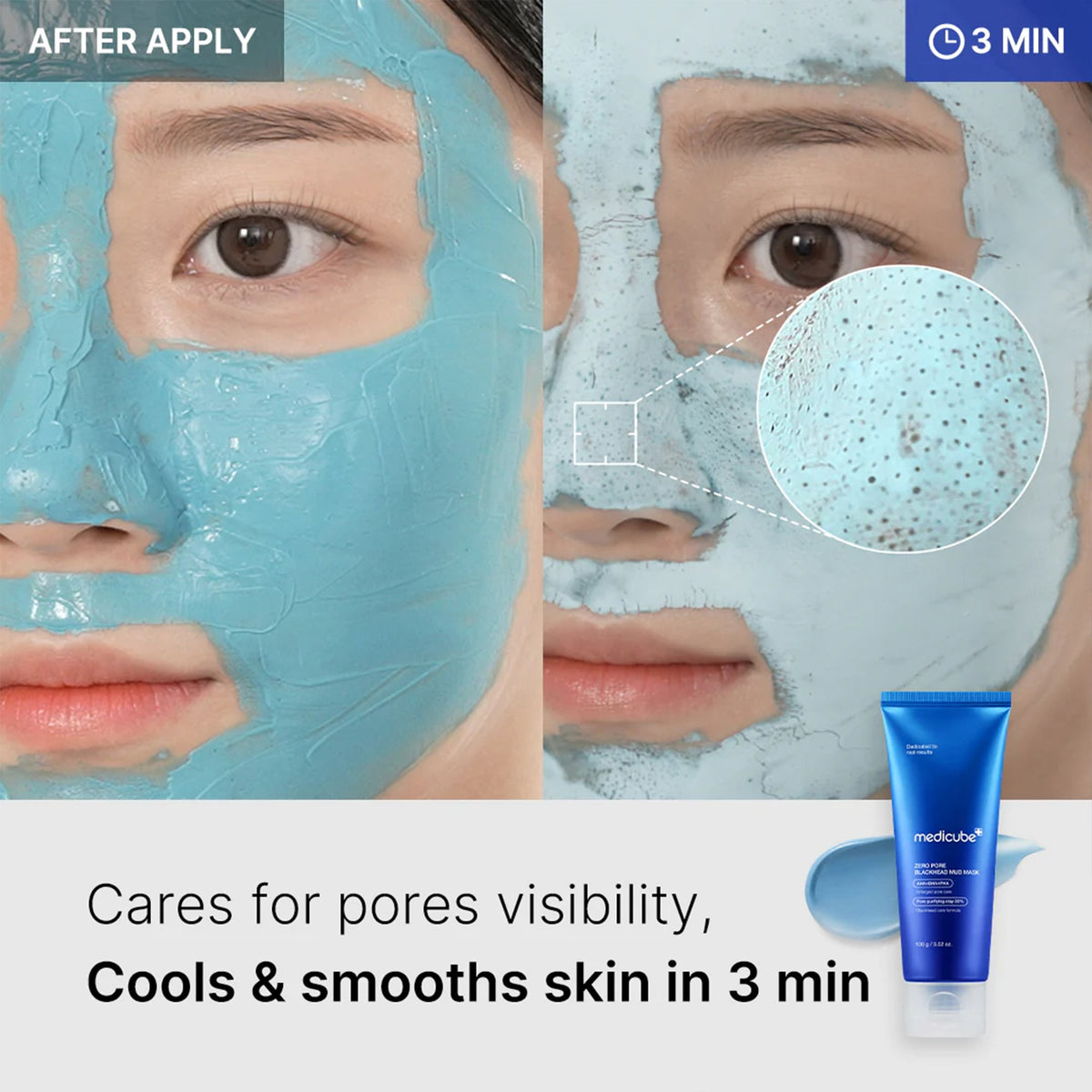 Masque à la boue anti-pores obstrués Zero Pore