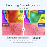 Masque à la boue anti-pores obstrués Zero Pore