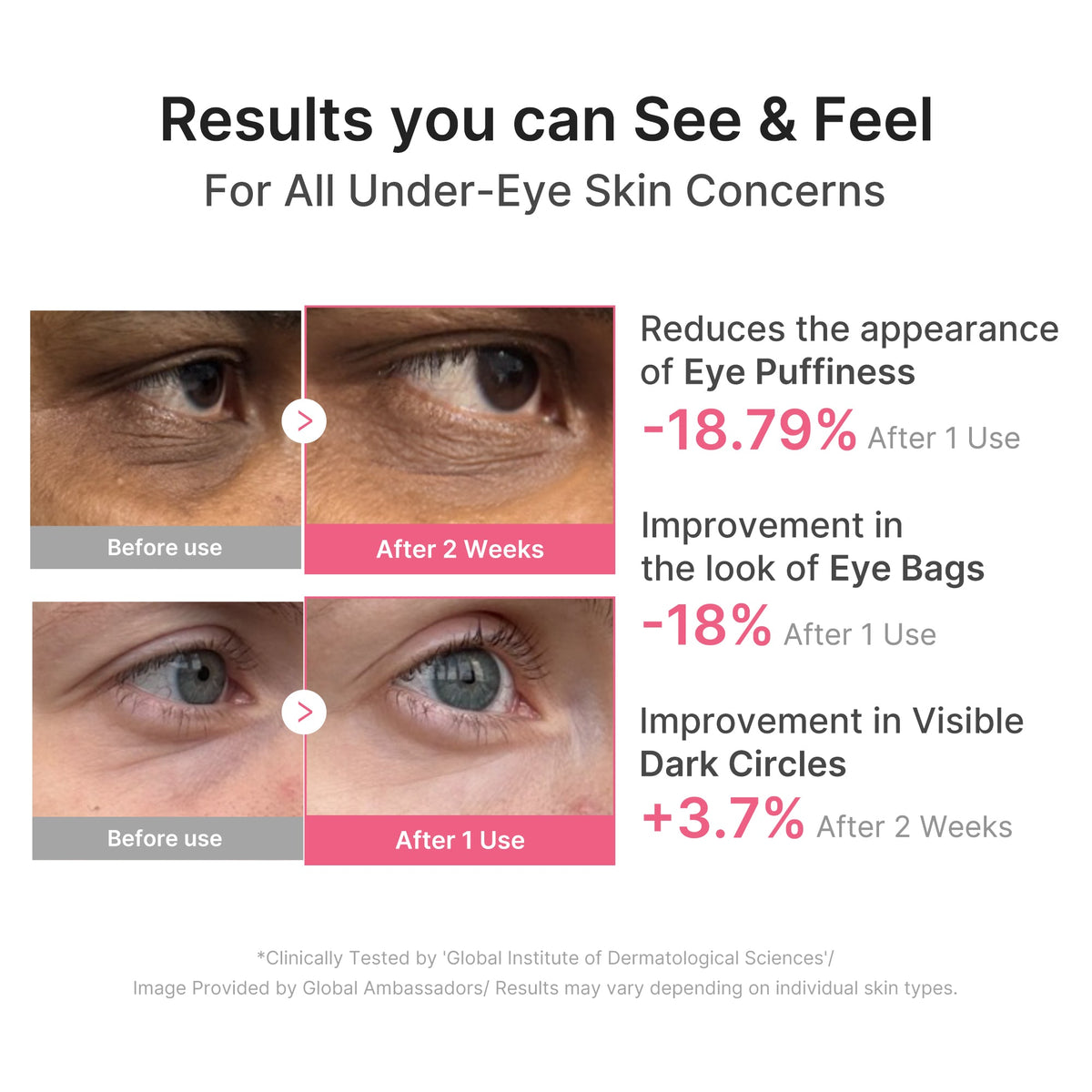 Patchs pour les yeux au collagène PDRN et à la caféine
