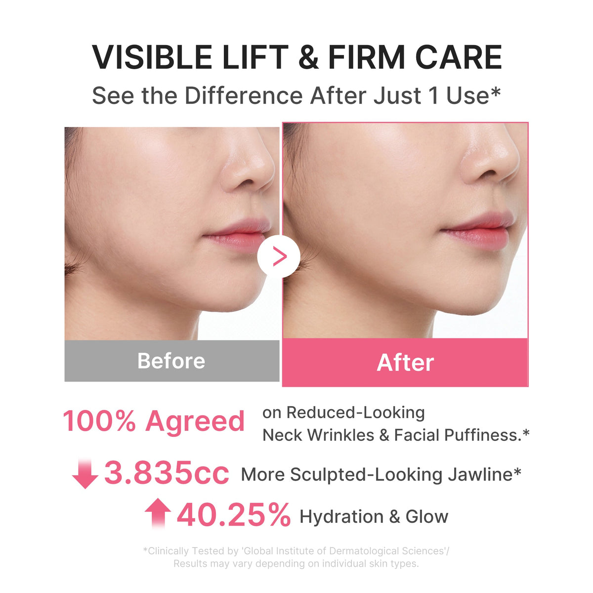 Crème anti-rides pour le cou au gua sha au collagène PDRN