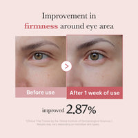 Crème contour des yeux aux peptides roses et au PDRN